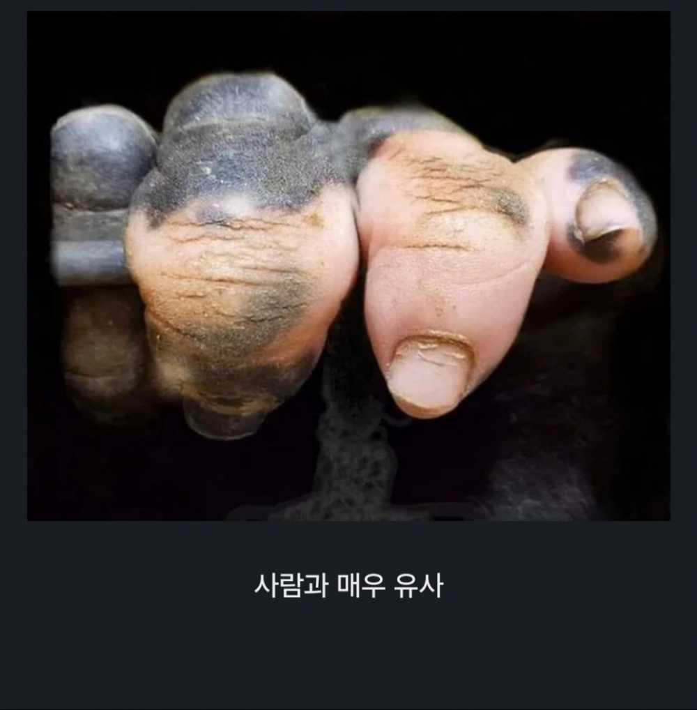 백반증에 걸린 고릴라의 손